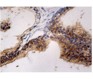 CLN5 Antibody (D-8) - Immunohistochemistry - Image 263023 