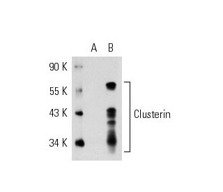 Clusterin-&alpha; Antibody (78E) - Western Blotting - Image 20394 