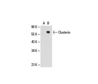 Clusterin Antibody (CLI-9) - Western Blotting - Image 20424 