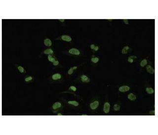 CMAS Antibody (14W) - Immunofluorescence - Image 35583 