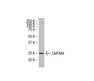 CMTM4 Antibody (1E8) - Western Blotting - Image 33593The Double Nickase Plasmid features a U6 promoter for sgRNA expression, a 20 nt targeting sequence, and a gRNA scaffold to guide Cas9n. It includes a CBh promoter for Cas9n (D10A) and puromycin resistance, GFP for transfection verification, and nuclear localization signals (NLS). The 2A peptide allows co-expression of Cas9n and Puro from a single promoter, enabling precise genome editing with reduced off-target effects.