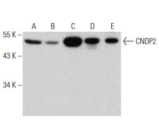 CNDP2 Antibody (AT15E5) - Western Blotting - Image 385125