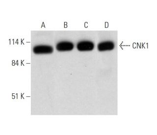 CNK1 Antibody (G-7) - Western Blotting - Image 324815