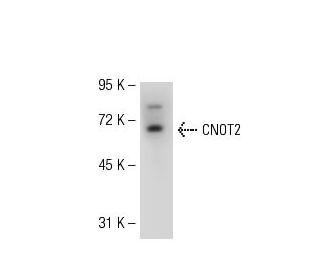 CNOT2 Antibody (2191C2a) - Western Blotting - Image 50839 