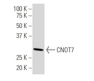 CNOT7 Antibody (18W) - Western Blotting - Image 34373 