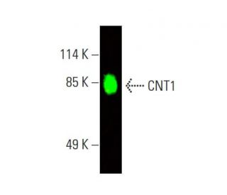 CNT1 Antibody (G-7) - Western Blotting - Image 388271The Double Nickase Plasmid features a U6 promoter for sgRNA expression, a 20 nt targeting sequence, and a gRNA scaffold to guide Cas9n. It includes a CBh promoter for Cas9n (D10A) and puromycin resistance, GFP for transfection verification, and nuclear localization signals (NLS). The 2A peptide allows co-expression of Cas9n and Puro from a single promoter, enabling precise genome editing with reduced off-target effects.