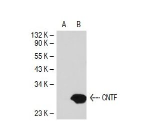 CNTF (A-11): sc-25286. Western blot analysis of CNTF expression in... 