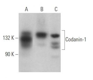 Codanin-1 Antibody (G-1) - Western Blotting - Image 366383 