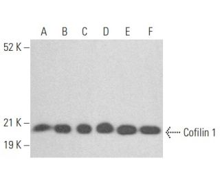 Cofilin 1 Antibody (5) - Western Blotting - Image 353963