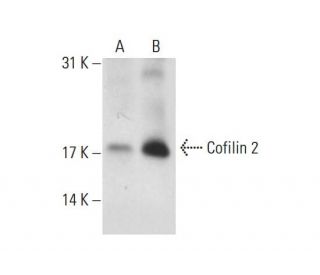 Cofilin 2 Antibody (D-5) - Western Blotting - Image 127167 