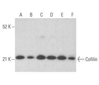 Cofilin Antibody (E-8) - Western Blotting - Image 353996 