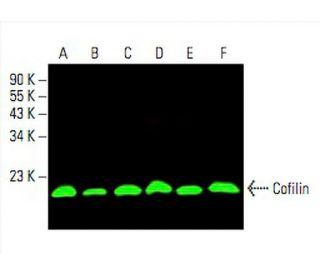 Cofilin Antibody (E-8) - Western Blotting - Image 393997