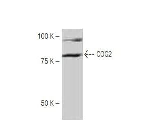 COG2 Antibody (GA99) - Western Blotting - Image 53944