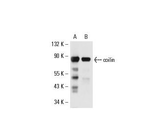 coilin Antibody (H1) - Western Blotting - Image 17755