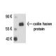 coilin Antibody (Pdelta) - Western Blotting - Image 15848