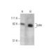 coilin Antibody (Pdelta) - Western Blotting - Image 283508 
