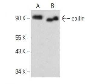 coilin Antibody (Pdelta) - Western Blotting - Image 356635 