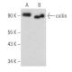 coilin Antibody (Pdelta) - Western Blotting - Image 356635 