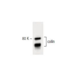 coilin Antibody (56) - Western Blotting - Image 60270