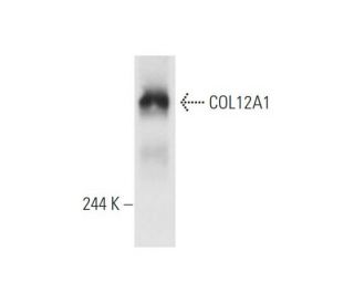 COL12A1 Antibody (A-11) - Western Blotting - Image 63006Each CRISPR/Cas9 Knockout (KO) Plasmid product consists of a pool of 3 plasmids designed to ensure identification and cleavage of a specific gene for maximum knockout efficiency. Each plasmid encodes a unique 20 nt sequence derived from the GeCKO (v2) library.