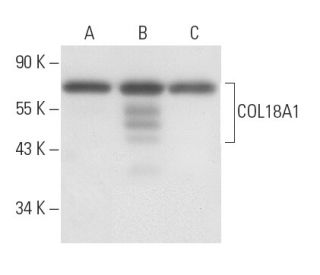 COL18A1 Antibody (1837-46) - Western Blotting - Image 11274 