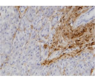 COL1A1 Antibody (3G3) - Immunohistochemistry - Image 346114 