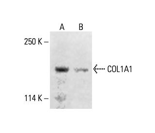 COL1A1 Antibody (H-7) - Western Blotting - Image 411992