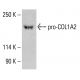 COL1A2 Antibody (G-4) - Western Blotting - Image 413808 