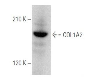 COL1A2 Antibody (H-9) - Western Blotting - Image 354139 