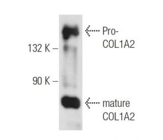 COL1A2 Antibody (G-4) - Western Blotting - Image 109573