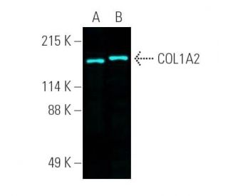COL1A2 Antibody (H-9) - Western Blotting - Image 390740