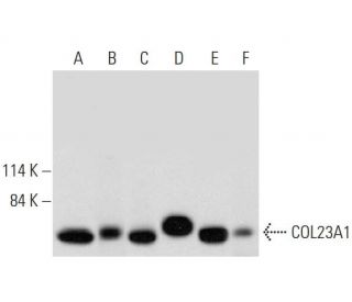 COL23A1 Antibody (C-10) - Western Blotting - Image 333420
