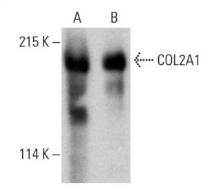 COL2A1 Antibody (B-1) - Western Blotting - Image 387365 