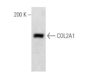 COL2A1 Antibody (M2139) - Western Blotting - Image 14010 