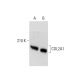 COL2A1 Antibody (M2139) - Western Blotting - Image 137874 