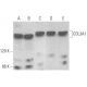 COL3A1 Antibody (C-6) - Western Blotting - Image 354008