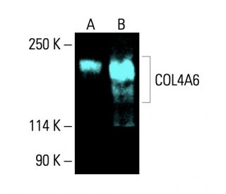 COL4A6 Antibody (G-2) - Western Blotting - Image 404843 
