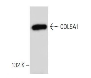 COL5A1 Antibody (H-12) - Western Blotting - Image 46159