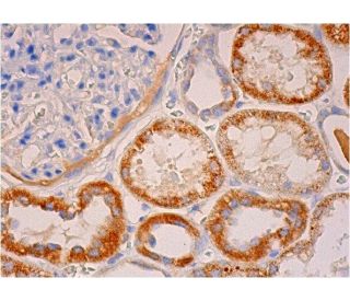 COL7A1 Antibody (LH7.2) - Immunohistochemistry - Image 293342