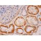COL7A1 Antibody (LH7.2) - Immunohistochemistry - Image 293342