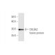 COL8A2 Antibody (1F4) - Western Blotting - Image 348460