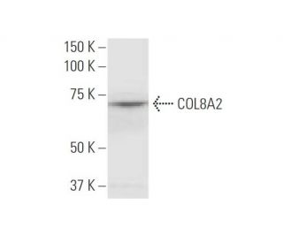 COL8A2 Antibody (1F4) - Western Blotting - Image 347544SAM Transcription Activation: SAM system utilizing dCas9-VP64, MS2-P65-HSF1, and sgRNA for precise gene transcription activation.