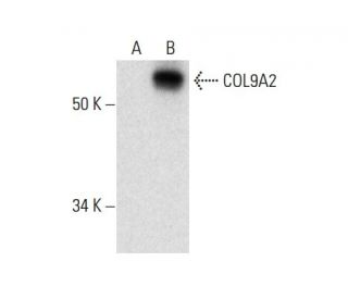 COL9A2 Antibody (H-8) - Western Blotting - Image 301409 