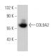 COL9A2 Antibody (H-8) - Western Blotting - Image 366339 