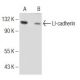 I-cadherin (C-17): sc-6978. Western blot analysis of LI-cadherin expression in Jurkat (A) and COLO 205 (B) whole cell lysa 