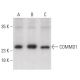 COMMD1 Antibody (B-3) - Western Blotting - Image 399628 