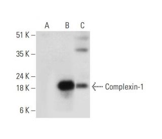 Complexin-1/2 Antibody (B-9) - Western Blotting - Image 318413