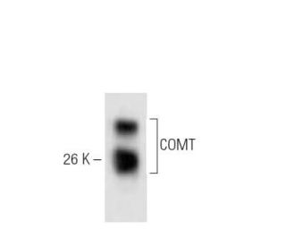 COMT Antibody (4) - Western Blotting - Image 60271 