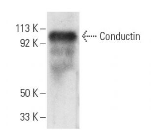 Conductin Antibody (C-6) - Western Blotting - Image 3888Each CRISPR/Cas9 Knockout (KO) Plasmid product consists of a pool of 3 plasmids designed to ensure identification and cleavage of a specific gene for maximum knockout efficiency. Each plasmid encodes a unique 20 nt sequence derived from the GeCKO (v2) library.