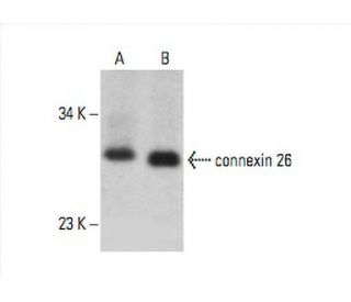 connexin 26 Antibody (P1F5) - Western Blotting - Image 392594SAM Transcription Activation: SAM system utilizing dCas9-VP64, MS2-P65-HSF1, and sgRNA for precise gene transcription activation.